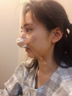 総額420万をかけてコンプレックスを解消　10回の施術から起業した女性「美容整形を努力だという文化を作りたい」