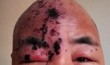 報告は氷山の一角！コロナワクチン接種後の副反応、死亡のツイートが多すぎて戦慄！vol.384 | 泣いて生まれてきたけれど