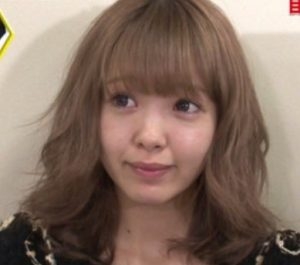 藤田ニコル〝医療版〟小顔施術を受けると告白「メチャクチャ痛いらしくて…」