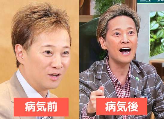 中居正広 「キャスターな会」で自身の体調に言及「見ての通り痩せたでしょ?」 1カ月の休養発表後初放送