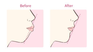 ガル民の教えを実践している人　美容編