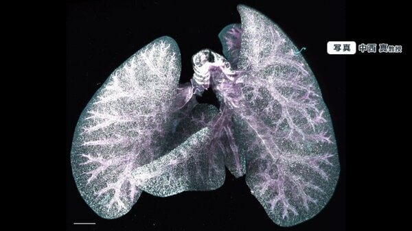“老化”防げる可能性「老化細胞の除去」に東大が成功　最新研究に世界も注目｜FNNプライムオンライン