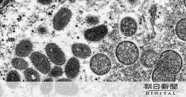 サル痘の名称「mpox」に変更 WHO、動物福祉などへ配慮 | ガールズちゃんねる - Girls Channel