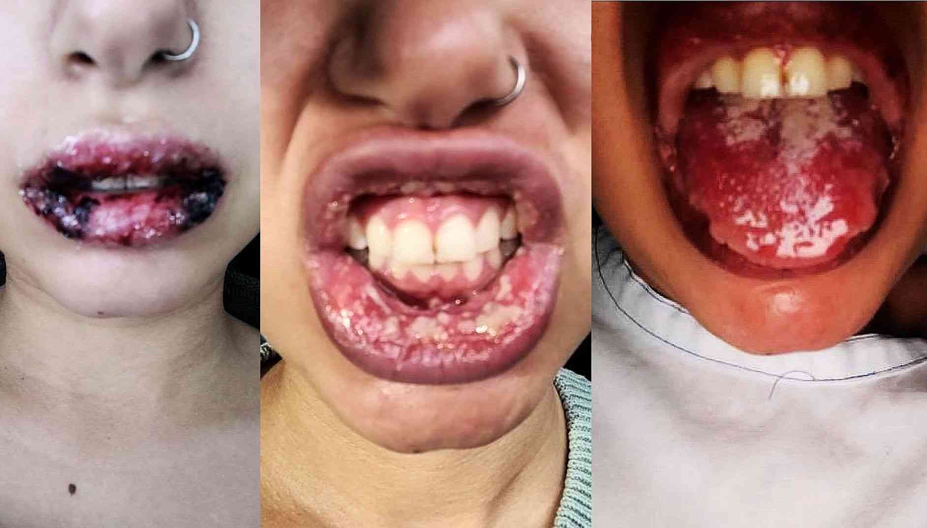 報告は氷山の一角！コロナワクチン接種後の副反応、死亡のツイートが多すぎて戦慄！vol.432 | 泣いて生まれてきたけれど