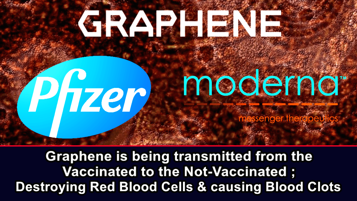 Graphene is being transmitted from the Vaccinated to the Not-Vaccinated; destroying Red Blood Cells & causing Blood Clots – The Expose