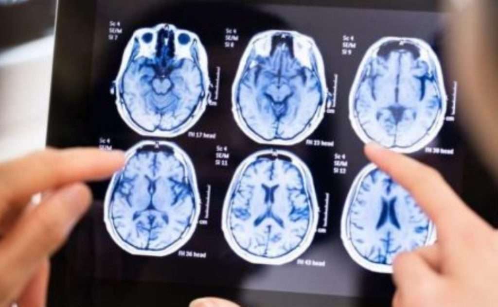 Australian National Review - Shocking Study Reveals mRNA COVID-19 Vaccines May Progressively Degenerate Your Brain From Prion Disease