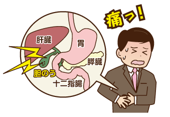 胆のう炎（胆嚢）・胆石で悩んでいる人お話ししたいです