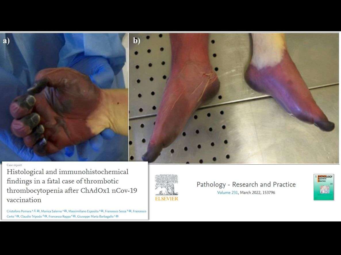 報告は氷山の一角！コロナワクチン接種後の副反応、死亡のツイートが多すぎて戦慄！vol.434 | 泣いて生まれてきたけれど