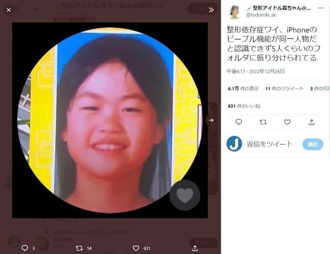 顔が変わりすぎて「iPhoneが同一人物だと認識できない」 総額1300万整形アイドル、美容整形の思わぬ弊害告白