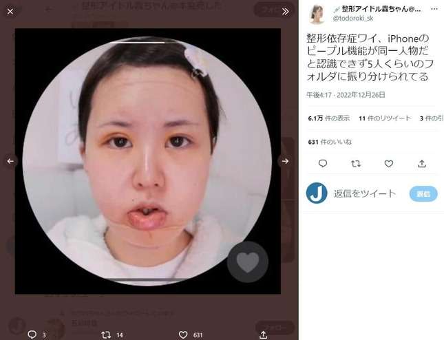 顔が変わりすぎて「iPhoneが同一人物だと認識できない」 総額1300万整形アイドル、美容整形の思わぬ弊害告白