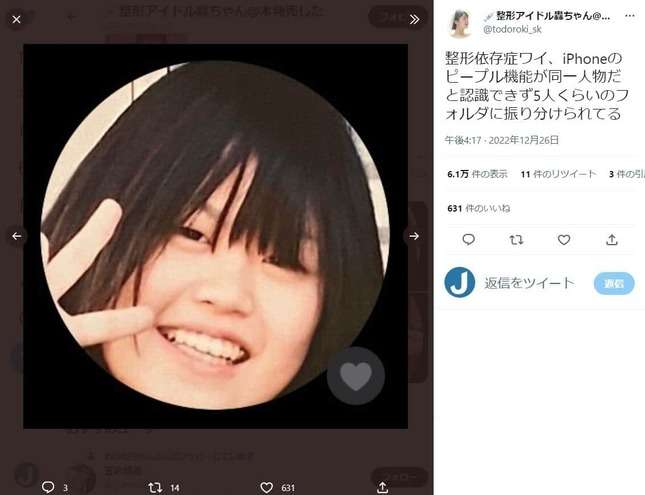 顔が変わりすぎて「iPhoneが同一人物だと認識できない」 総額1300万整形アイドル、美容整形の思わぬ弊害告白