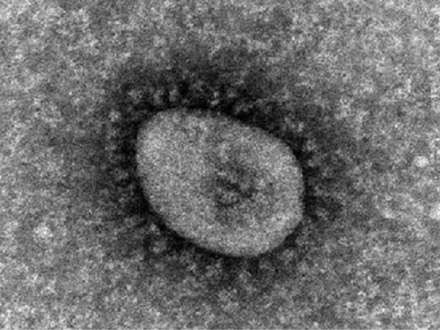 コロナウイルスのゲノム変異に未知の仕組みか、大流行解明に光 東北大 | Science Portal - 科学技術の最新情報サイト「サイエンスポータル」