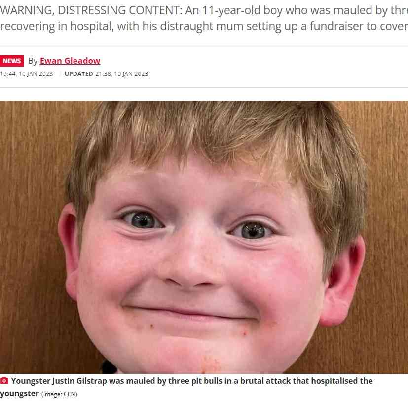 【海外発！Breaking News】自転車に乗っていた11歳男児、ピットブル3頭に襲われ頭皮の70％を失う重傷（米） | Techinsight（テックインサイト）|海外セレブ、国内エンタメのオンリーワンをお届けするニュースサイト