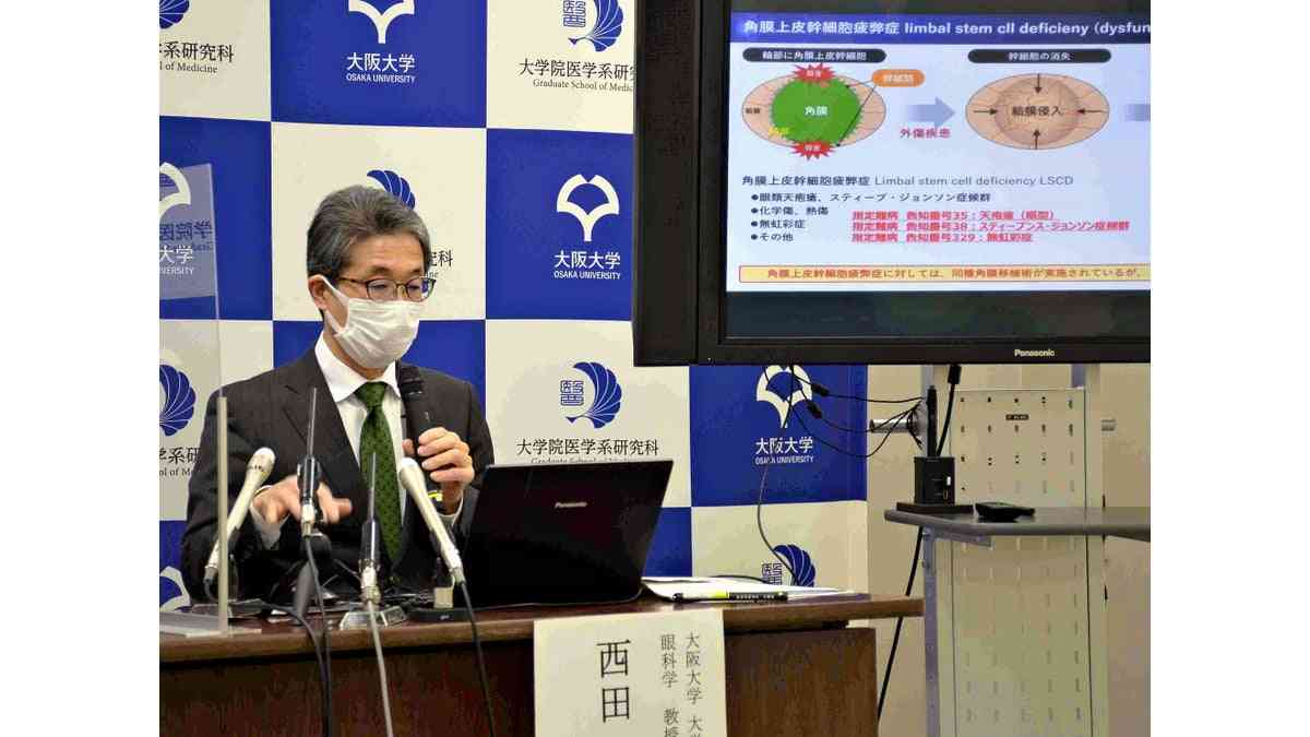 ｉＰＳ細胞から作った角膜シート移植、ほぼ失明の患者が視力回復…大阪大 : 読売新聞オンライン