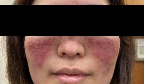 報告は氷山の一角！コロナワクチン接種後の副反応、死亡のツイートが多すぎて戦慄！vol.443 | 泣いて生まれてきたけれど