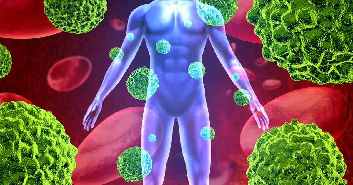 コロナ死亡例、脳を含む広範囲に長期ウイルスが存在／Nature｜医師向け医療ニュースはケアネット