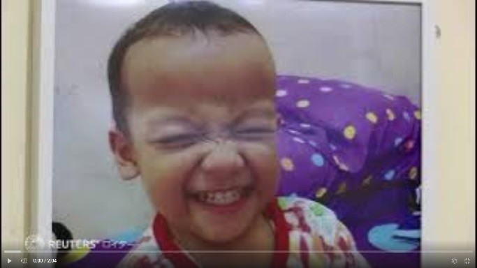 せき止めシロップ服用で子供が相次ぎ死亡、200人犠牲か インドネシア揺るがす悲劇、悲しみに耐える母｜よろず〜ニュース