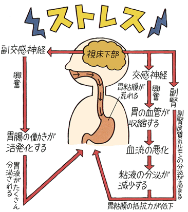 ストレスを感じると胃に来る