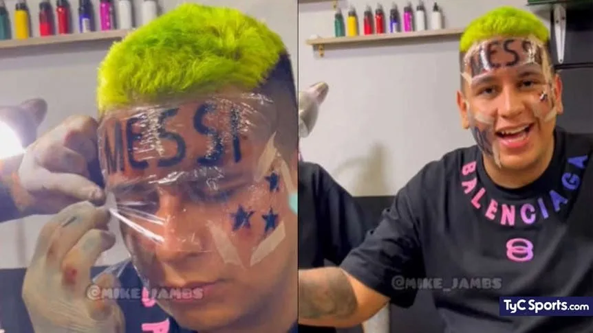 アルゼンチンのW杯優勝を記念し額に『メッシ』のタトゥーを入れたコロンビア人男性、「今は後悔してる」と語る