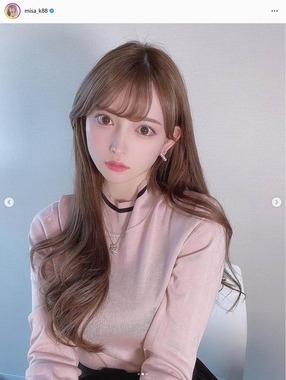 1700万整形モデルが「後悔した整形」4つ告白　「120万円損した」「本当に無駄だった」