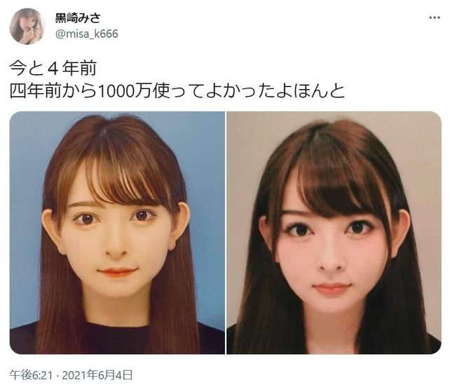 1700万整形モデルが「後悔した整形」4つ告白　「120万円損した」「本当に無駄だった」