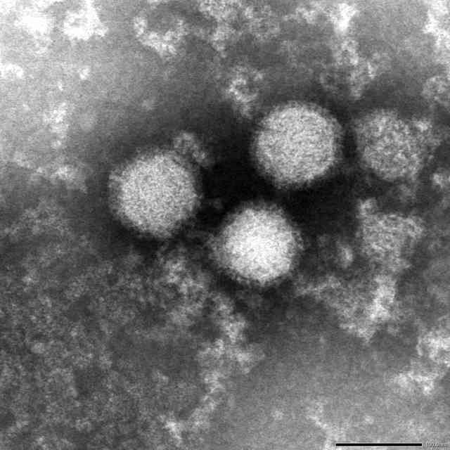 致死率高い出血熱SFTS、国内で拡大　ペットからヒト感染の可能性（朝日新聞デジタル） - Yahoo!ニュース