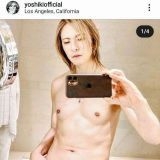 YOSHIKI、上半身裸自撮り写真で4年前手術から「ここまで回復」と報告 | ガールズちゃんねる - Girls Channel -