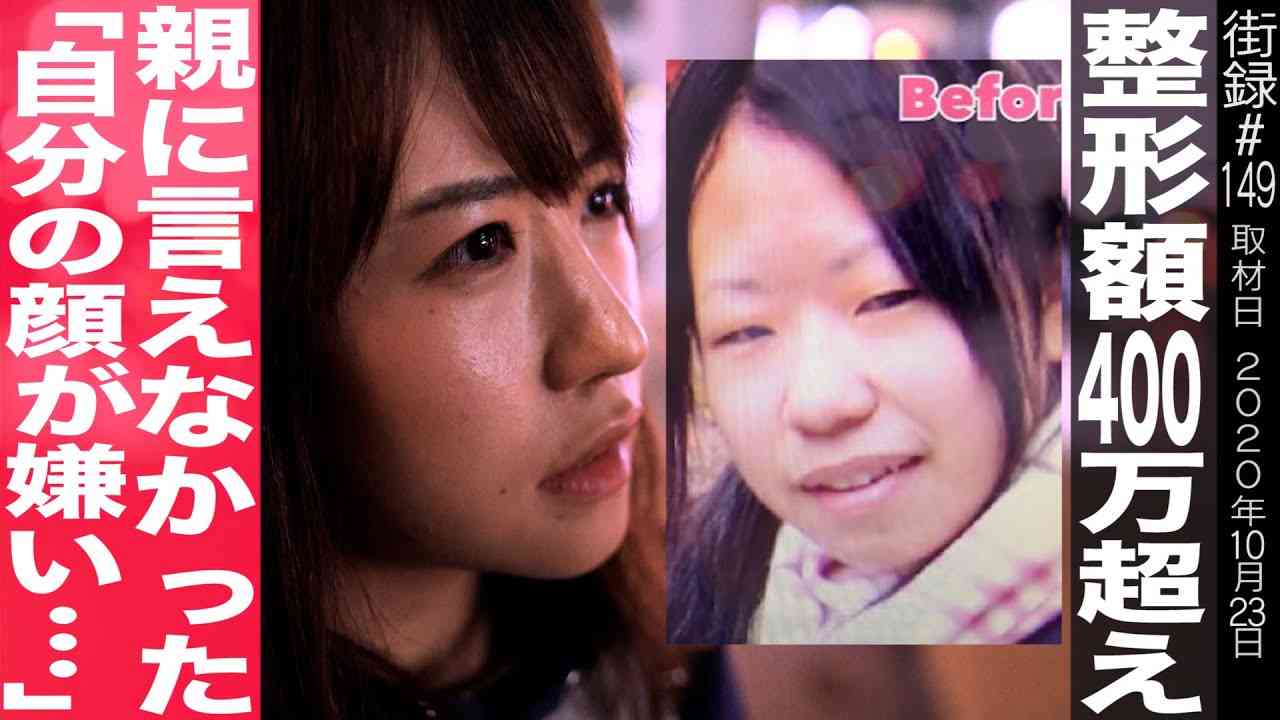 整形総額400万円超え/同級生からのいじめに「この顔のまま生きたくない…」 - YouTube