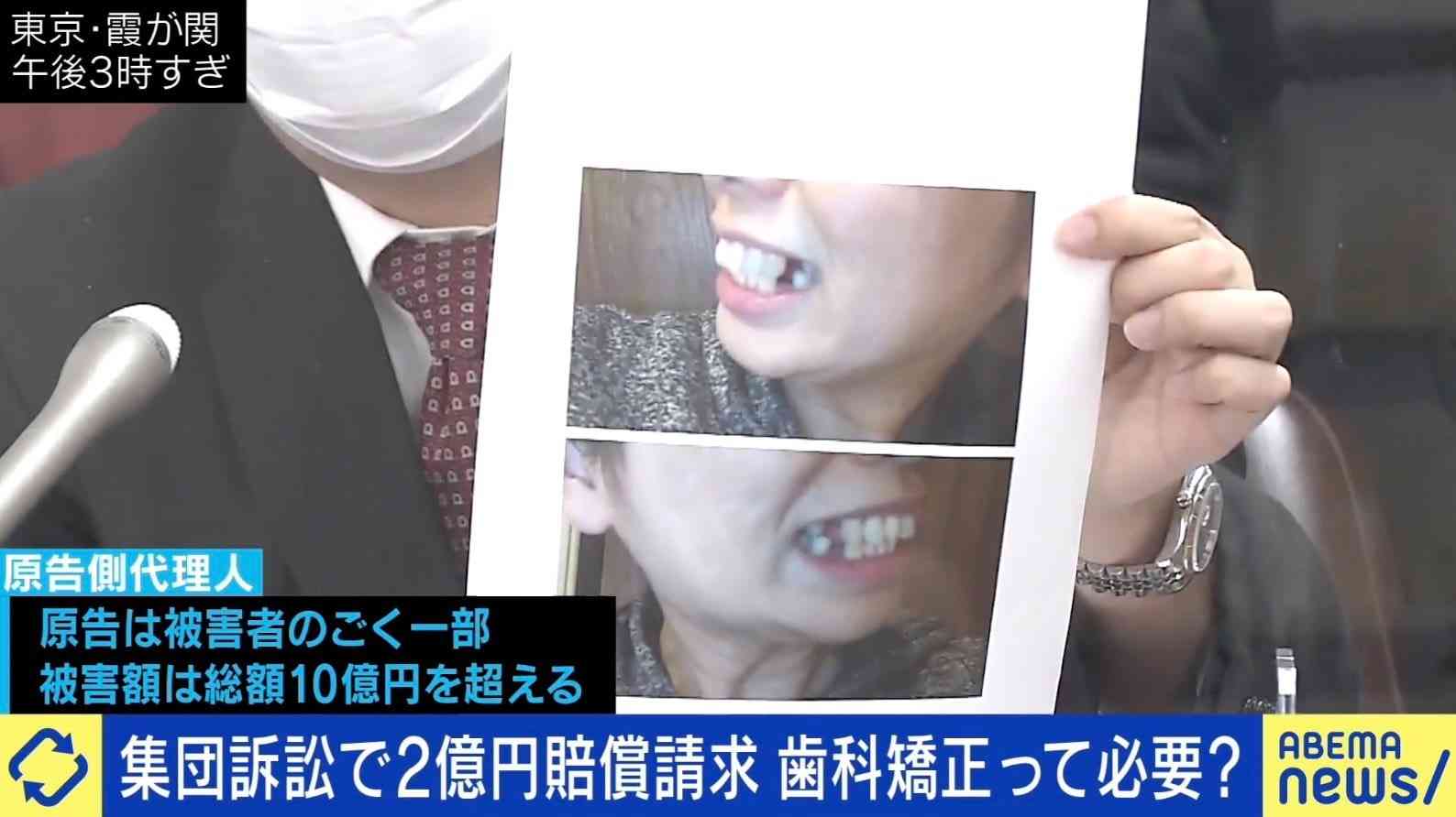 高額報酬で実質無料を謳う歯科矯正が裁判トラブルに 歯科医師「バカにされた。許せない」「医療から美容に足を踏み入れている」 | 国内 | ABEMA TIMES