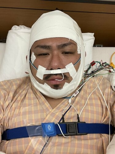 鬼越トマホーク・金ちゃん 睡眠時無呼吸症候群で検査入院「治す為にはここまでしないとダメなんだ」 病床の写真もアップ