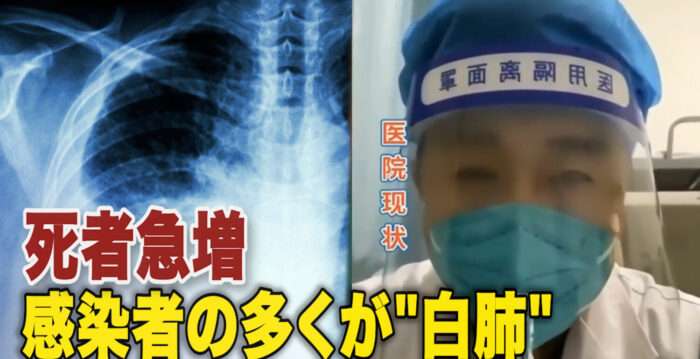 中国の感染者急増 多くの若者も「白肺」に | NTDTV Japan