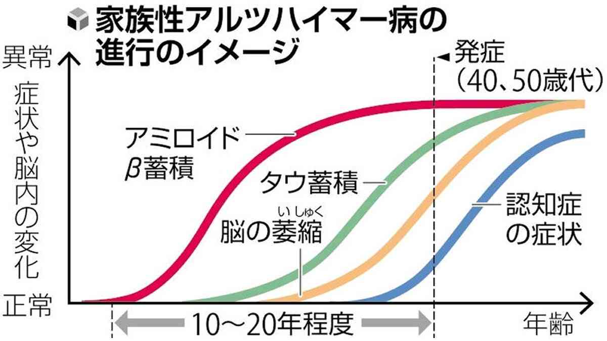 ４０・５０代でも発症、遺伝アルツハイマー治験を年内にも開始…原因物質を除去 : 読売新聞