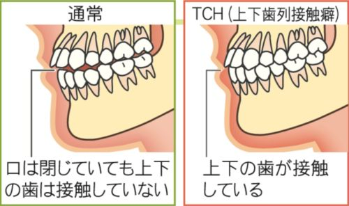 MEGUMI ほうれい線隠しで「鬼のように」濃いメイクの28歳時公開 顔面「負のスパイラル」