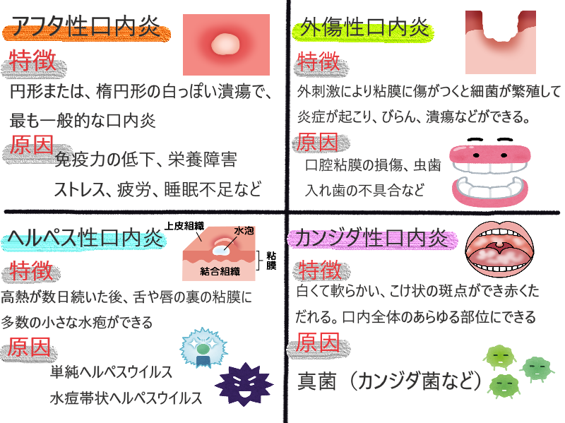 口内炎やヘルペスができやすい