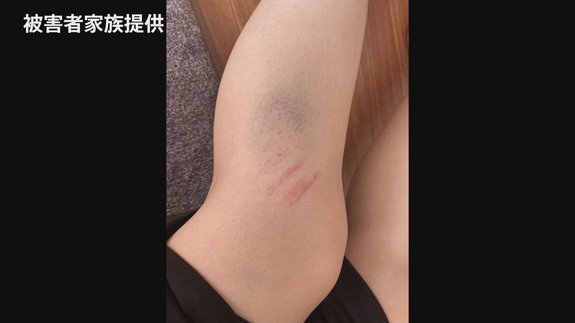 【独自】母親「心の傷深く、今も発作が」20歳の男が交際相手の女子高校生に6時間に及ぶ暴行　肋骨骨折などさせたか | TBS NEWS DIG (1ページ)