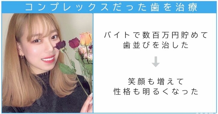 24歳の新婚ユーチューバー、家族で美容整形に「結婚式までにどうにかしないと」仕上がりに称賛の声