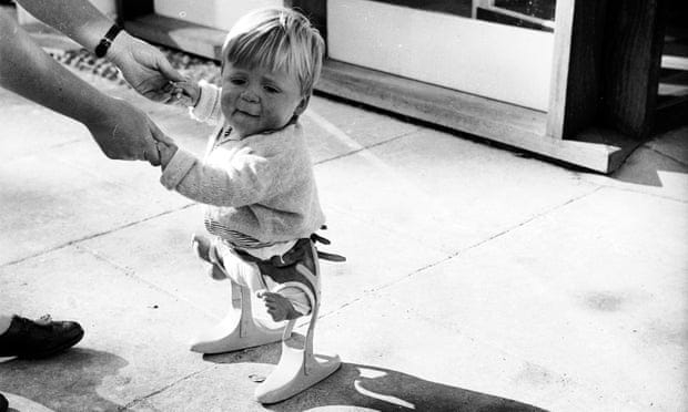 A miscarriage of statistics: The thalidomide sequel