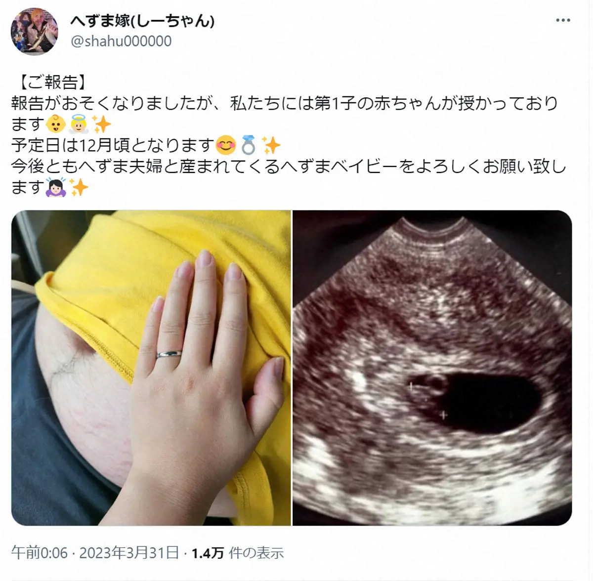 へずまりゅう妻、妊娠は“ウソ”の報告だった「大変言いづらいのですが…エイプリルフールと勘違い」