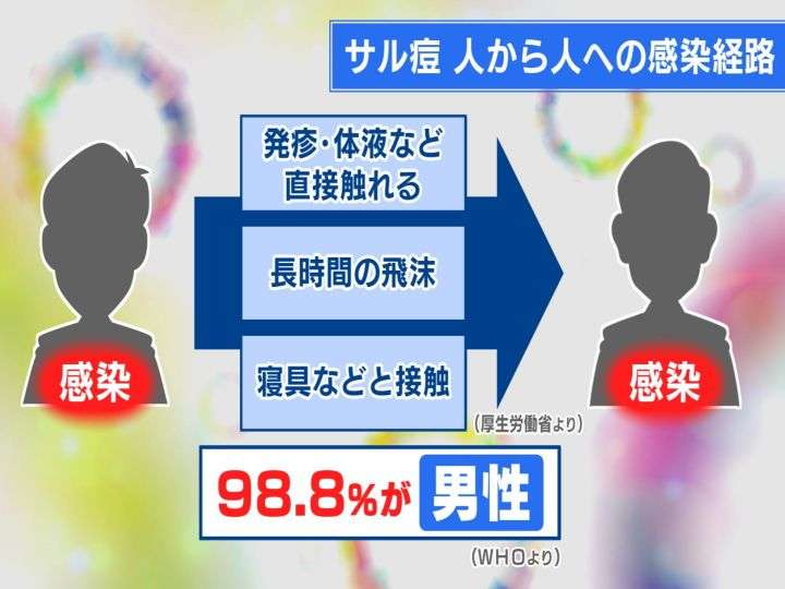 「サル痘」感染者が急増中今年に入り患者55人 厚労省が発疹症状に呼びかけ