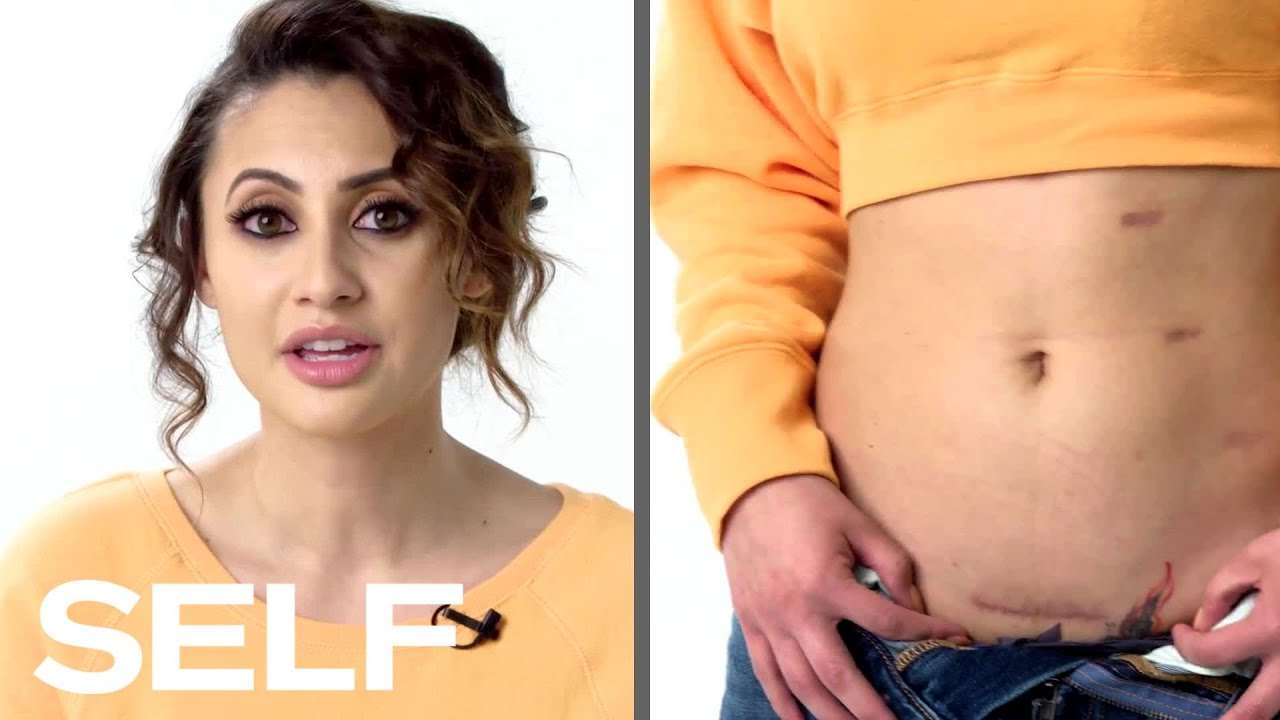 Francia Raisa Explains How She Became Selena Gomez's Kidney Donor | Body Stories | SELF - YouTube