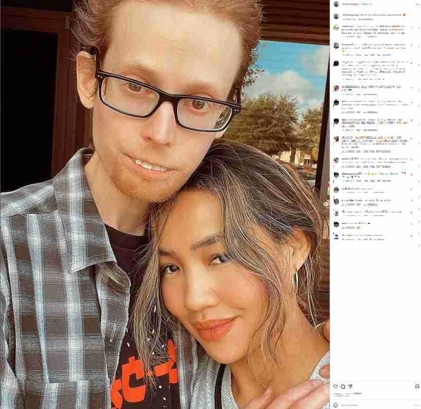 “醜い”と揶揄される男性と結婚した女性、「金目当て」との批判も夫婦は「幸せ!」と反論(米)