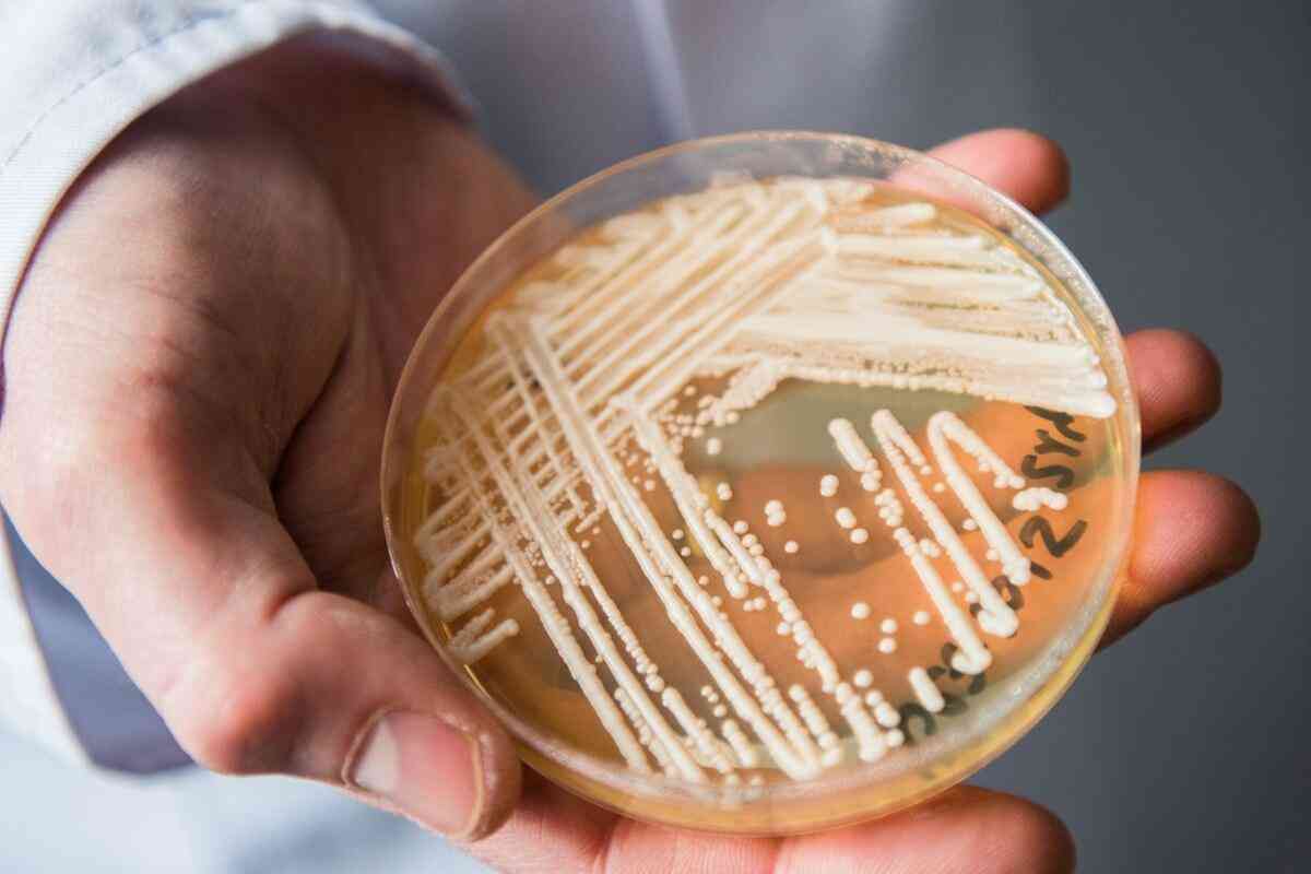 致死率30％超で薬剤耐性も、真菌カンジダ・アウリスが世界で拡大、「恐るべき勢い」と米CDC（ナショナル ジオグラフィック日本版） - Yahoo!ニュース