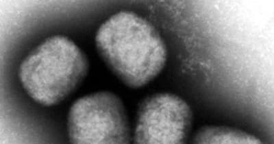 サル痘感染者、100人に迫る　厚労省「疑い症状相談を」 ｜ 共同通信