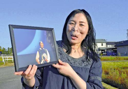 生まれつき鼻と口に変形がある私 「表に出ては駄目」から「隠れなくていいんだ」に変わった理由