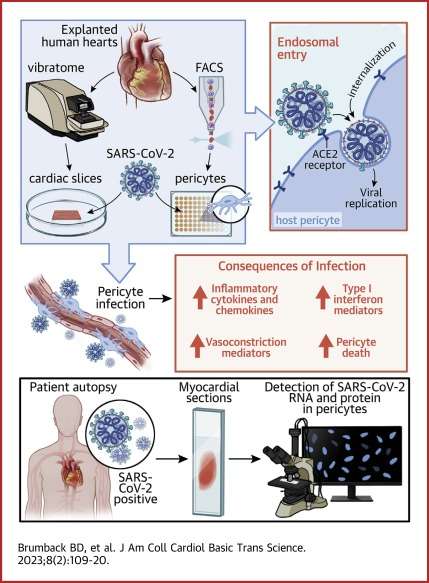 Human Cardiac Pericytes Are Susceptible to SARS-CoV-2 Infection - ScienceDirect
