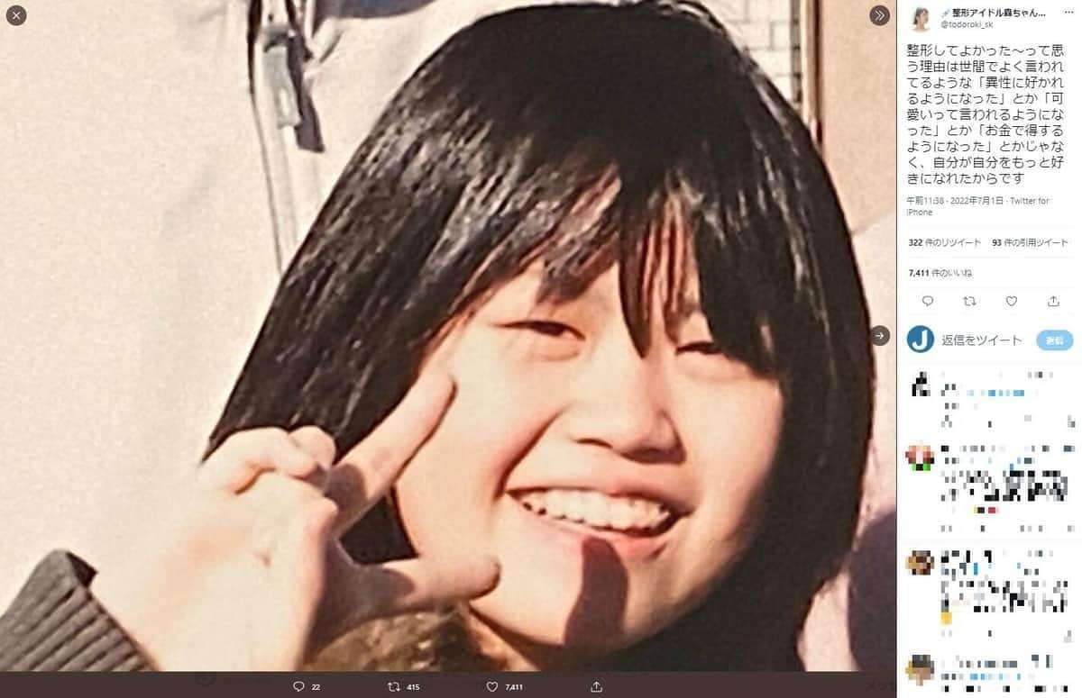 整形1350万アイドルに「子供産んだ時が楽しみだね！笑」　容姿めぐり壮絶中傷…「これが私の日常だった」
