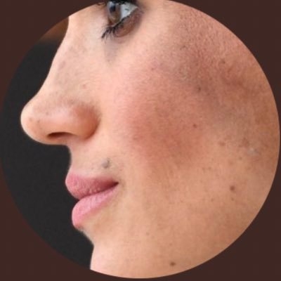 MeghansMole©️ on Twitter: 