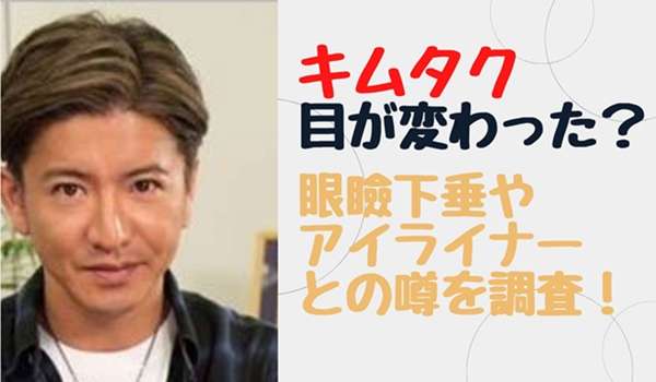 【2023最新】キムタクの目が変わったのは整形？眼瞼下垂やアイラインとも噂！ | Hi☆watashi