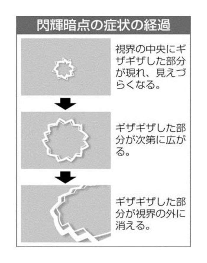緊張型頭痛がある人