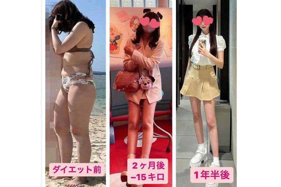 整形に300万円、減量15キロで壮絶過去と決別　一変した男性の目「180度扱いが変わりました」 | ENCOUNT
